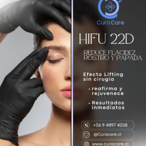 Lifting y rejuvenecimiento facial - HIFU 22D